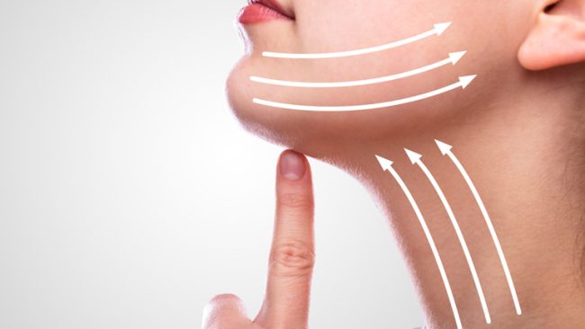 Chin and Neck Liposuction