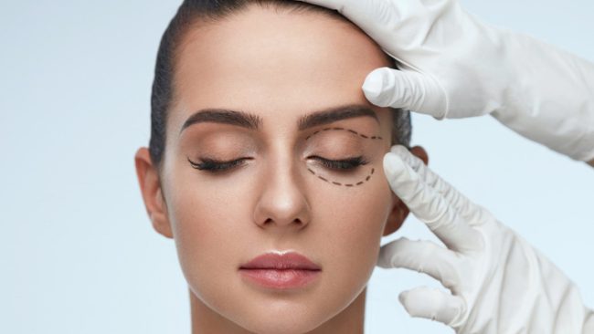 Eyelid Surgery