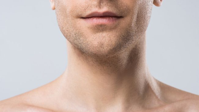 Male Neck Lift