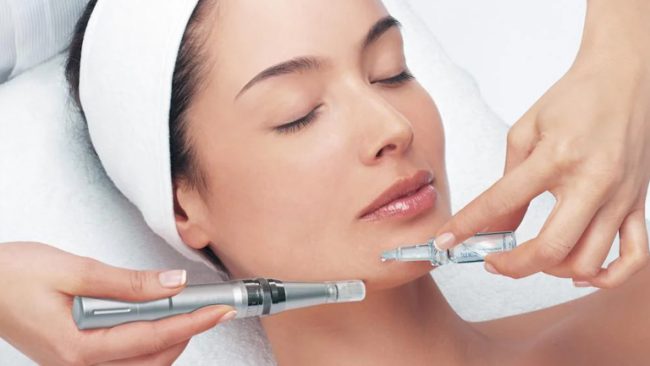 Microneedling