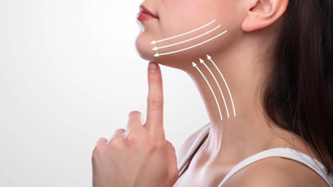 Neck Lift