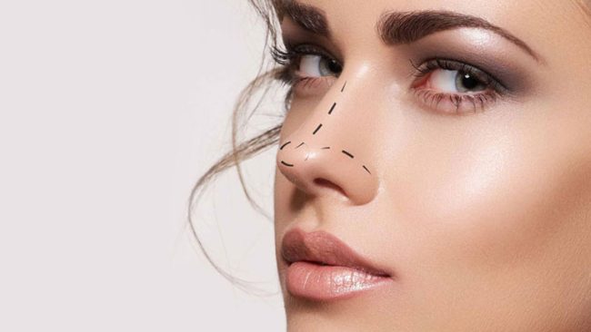 Rhinoplasty (Nose Job)