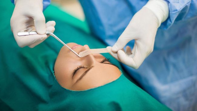 Septoplasty
