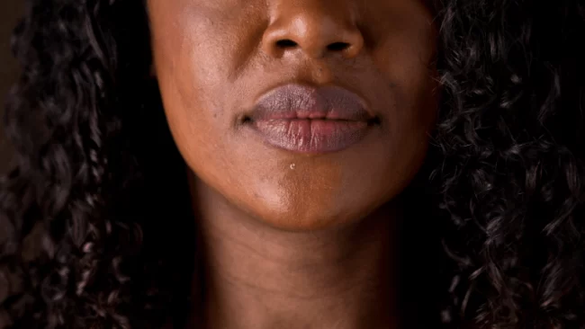 lip-reduction-surgery-london-uk-768×433
